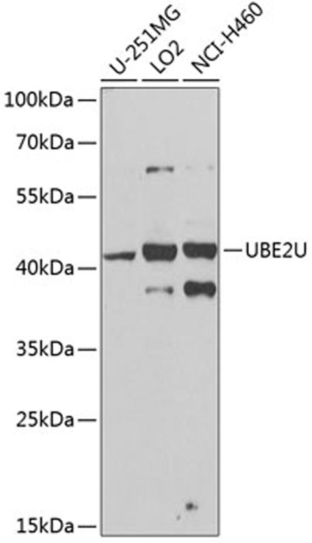 Western blot - UBE2U antibody (A8376)