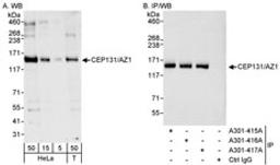 Detection of human CEP131/AZ1 by western blot and immunoprecipitation.