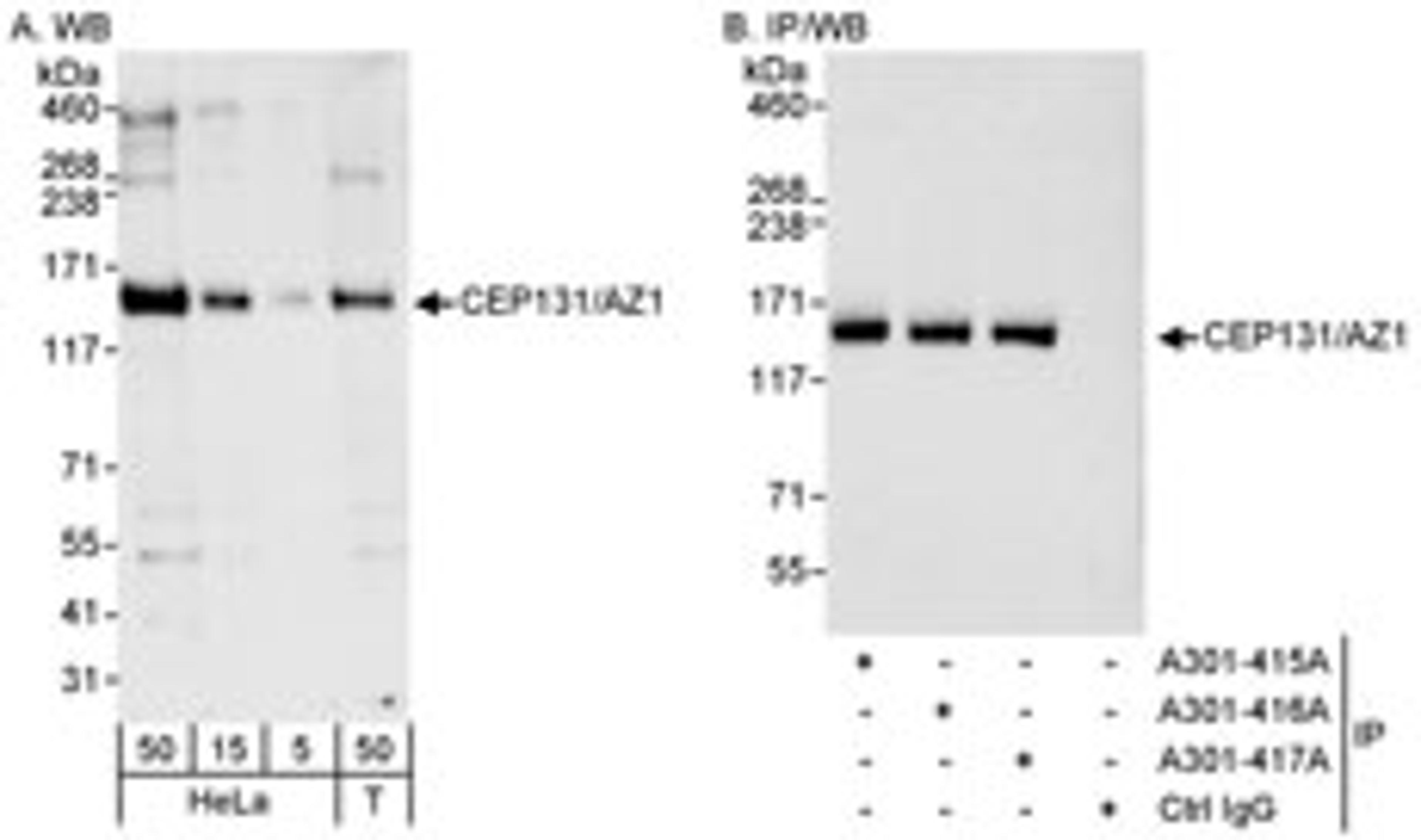 Detection of human CEP131/AZ1 by western blot and immunoprecipitation.