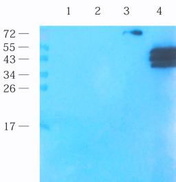 Western blot analysis of rat testis (lane 1), mouse brain (lane 2), rat kidney (lane 3), mouse lymph node (lane 4) using IFN gamma antibody (1 ug/ml)