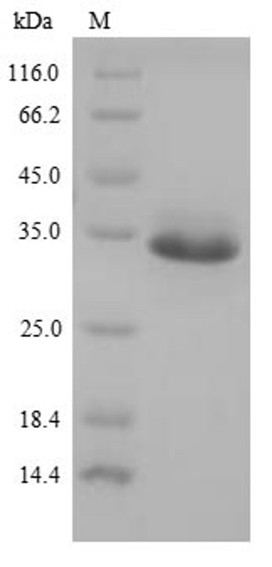 (Tris-Glycine gel) Discontinuous SDS-PAGE (reduced) with 5% enrichment gel and 15% separation gel.