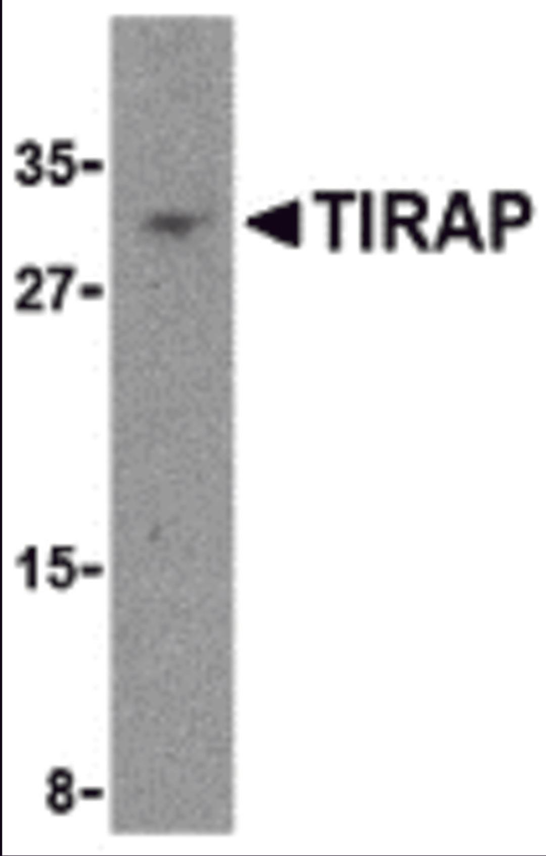 Western blot analysis of TIRAP in MCF-7 cell lysate with TIRAP antibody at 4 μg/mL.