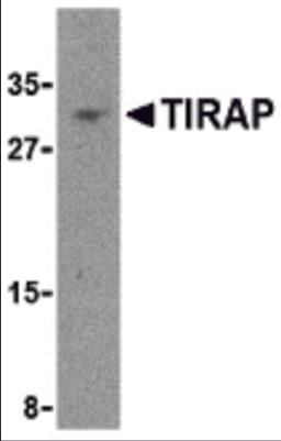 Western blot analysis of TIRAP in MCF-7 cell lysate with TIRAP antibody at 4 μg/mL.