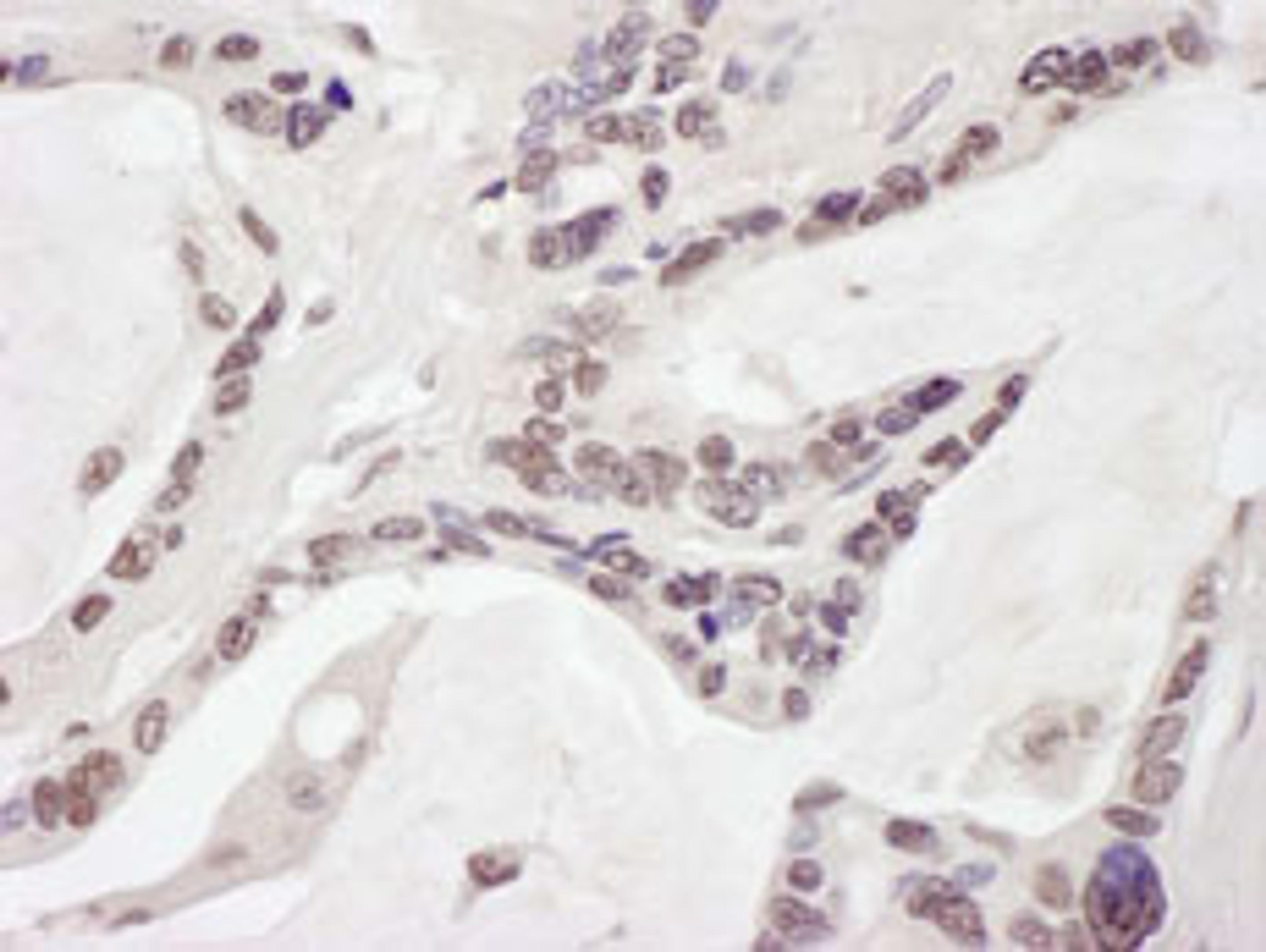 Detection of human ARID1B by immunohistochemistry.