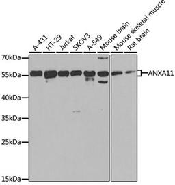 Western blot - ANXA11 antibody (A7423)