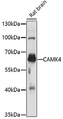 Western blot - CAMK4 antibody (A16787)