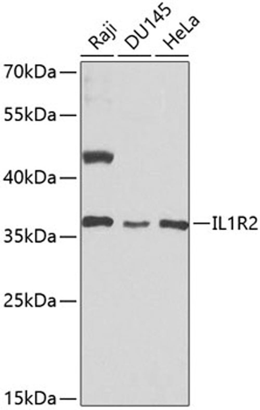 Western blot - IL1R2 antibody (A1899)