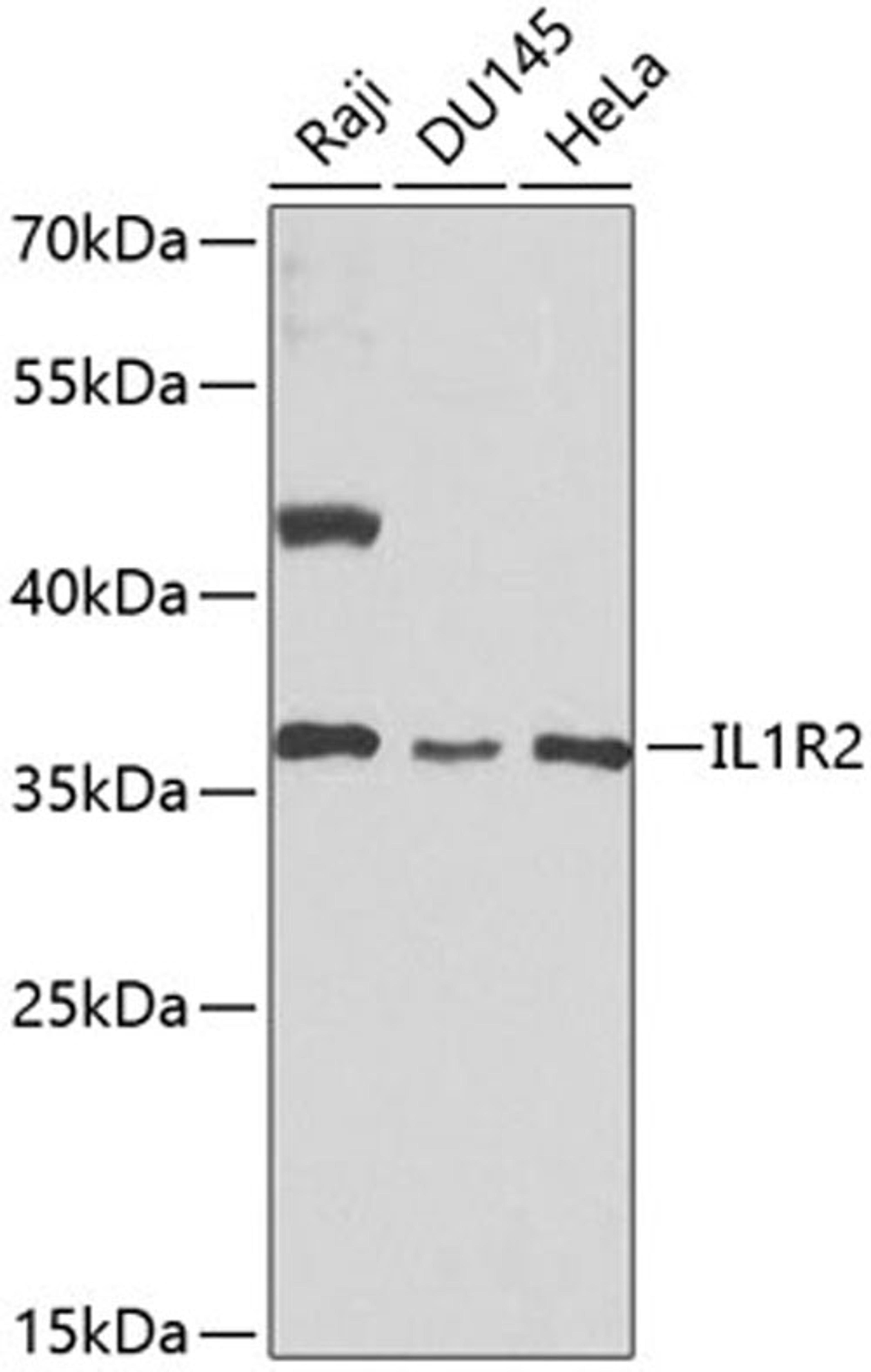 Western blot - IL1R2 antibody (A1899)