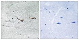 Immunohistochemistry-Paraffin: TOB1 Antibody [NBP1-55534] - Analysis of paraffin-embedded human brain tissue, using TOB1  Antibody. The picture on the right is treated with the synthesized peptide.