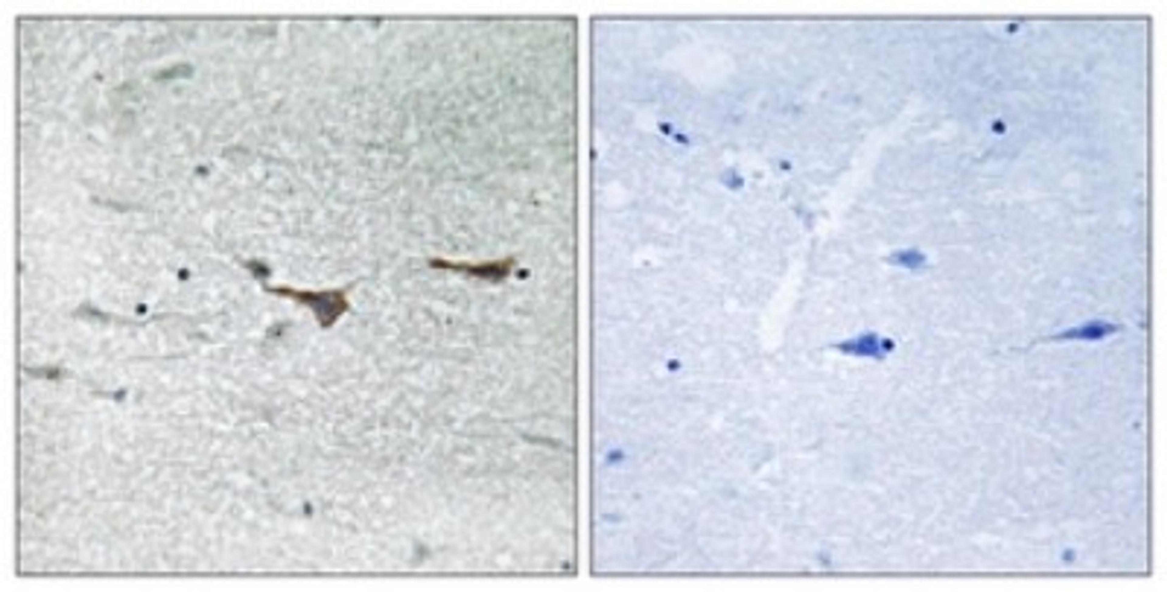 Immunohistochemistry-Paraffin: TOB1 Antibody [NBP1-55534] - Analysis of paraffin-embedded human brain tissue, using TOB1  Antibody. The picture on the right is treated with the synthesized peptide.