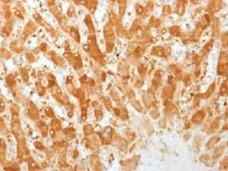 IHC testing of FFPE human liver with Connexin 32 antibody (clone GJB1/1753). Required HIER: boil tissue sections in 10mM citrate buffer, pH 6, for 10-20 min.