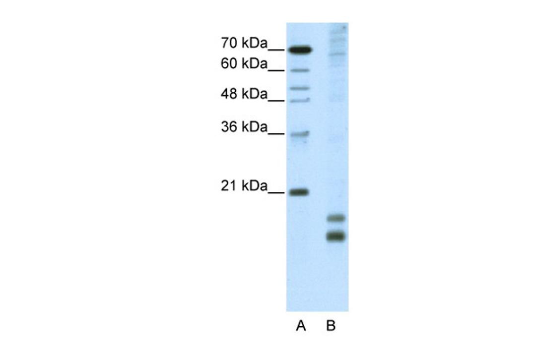 Antibody used in WB on Human HepG2 at 5.0 ug/ml.