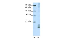 Antibody used in WB on Human HepG2 at 5.0 ug/ml.