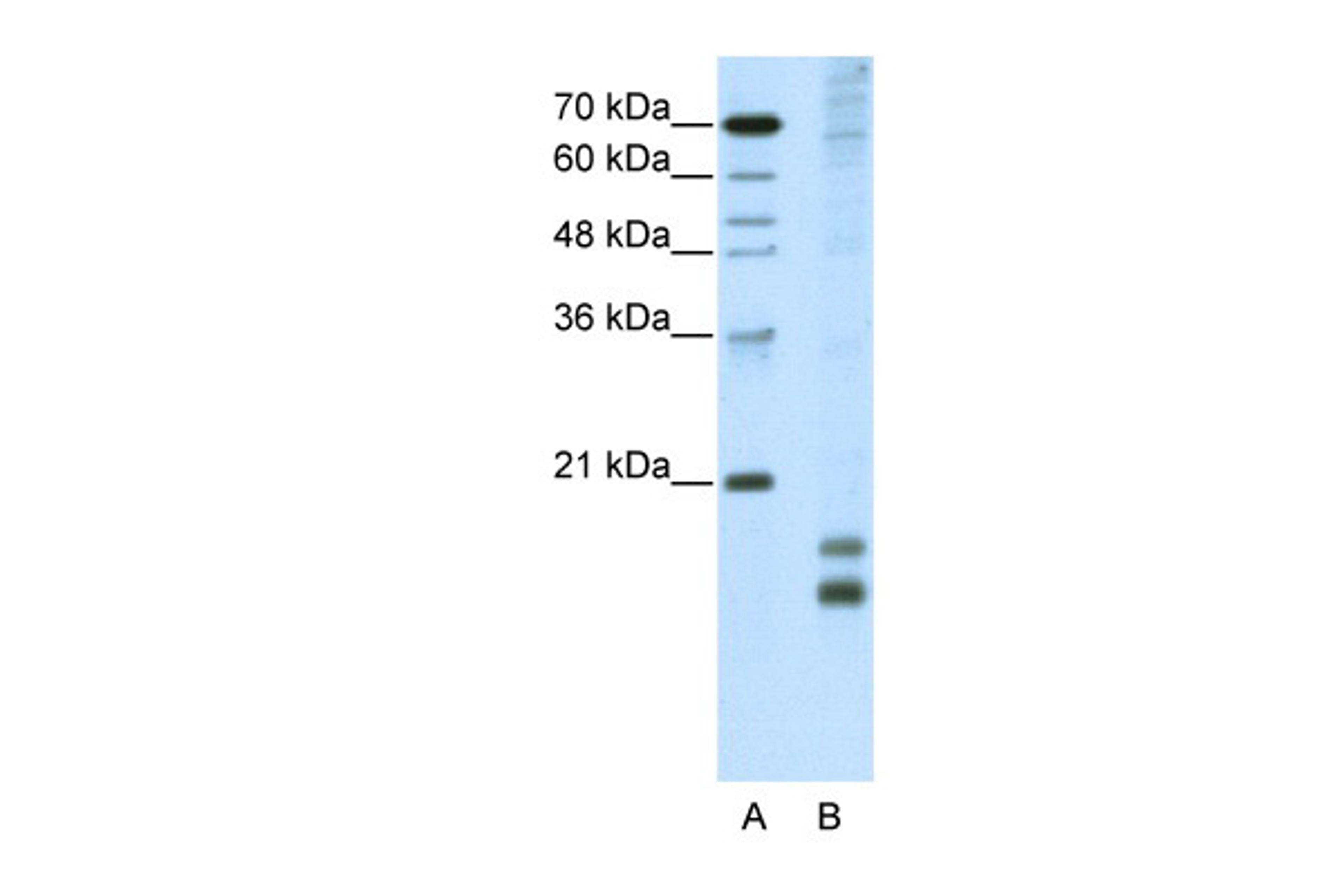 Antibody used in WB on Human HepG2 at 5.0 ug/ml.