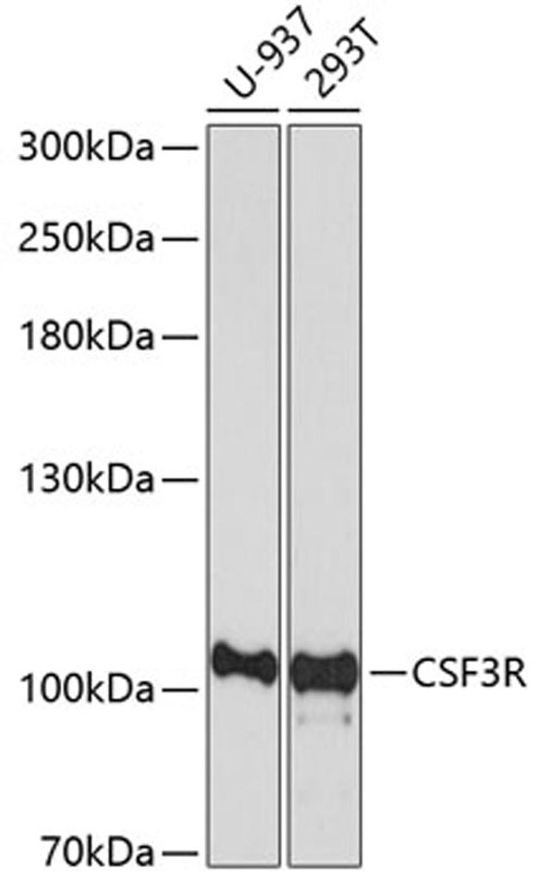 Western blot - CSF3R antibody (A7661)