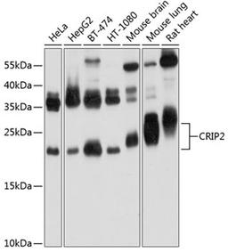 Western blot - CRIP2 Antibody (A9038)