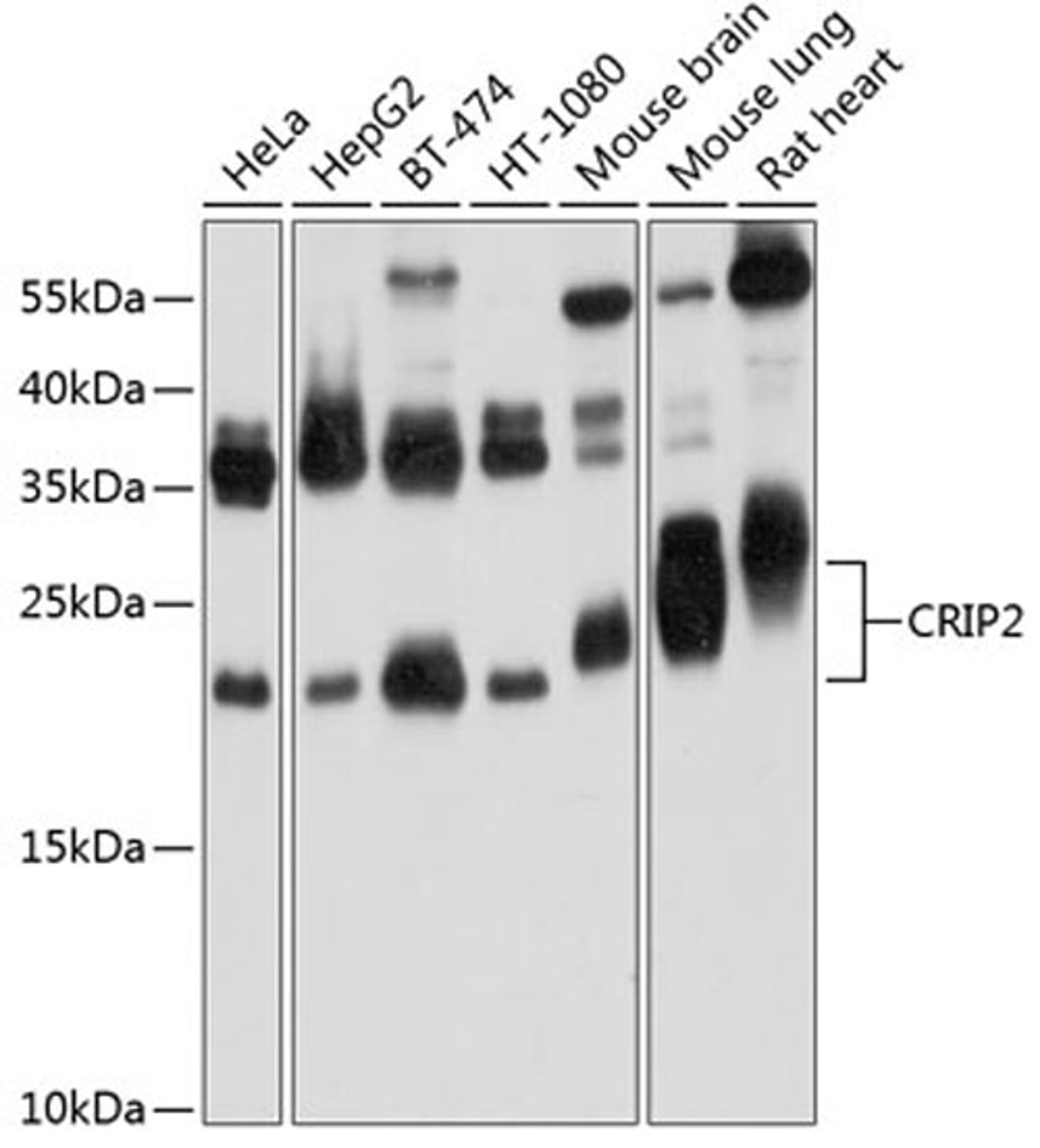 Western blot - CRIP2 Antibody (A9038)