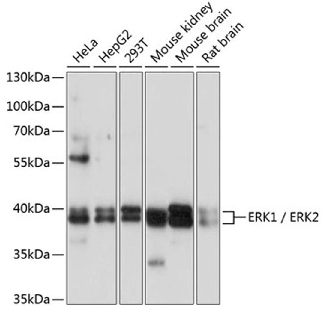 Western blot - ERK1 / ERK2 antibody (A16686)