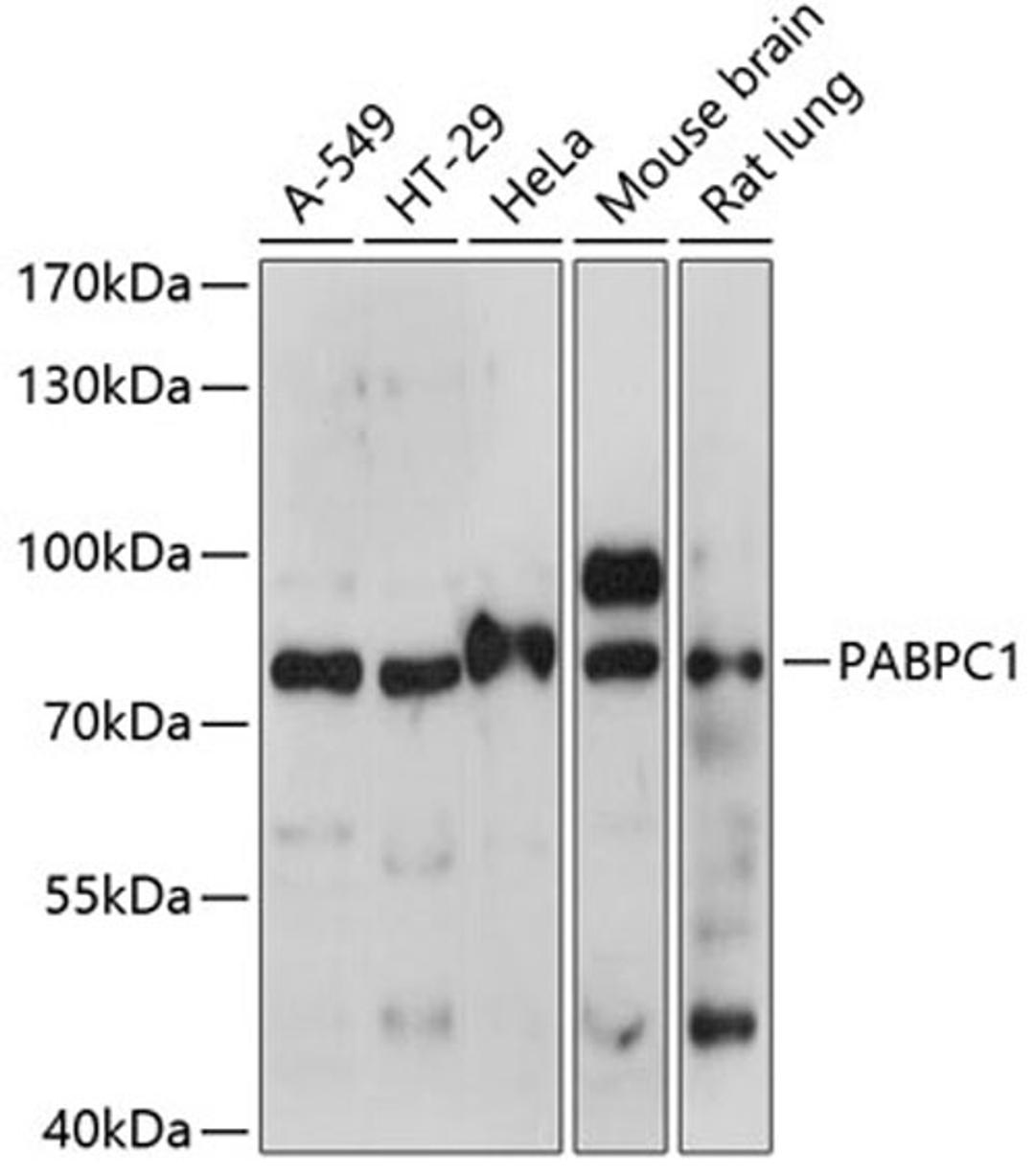 Western blot - PABPC1 antibody (A14872)