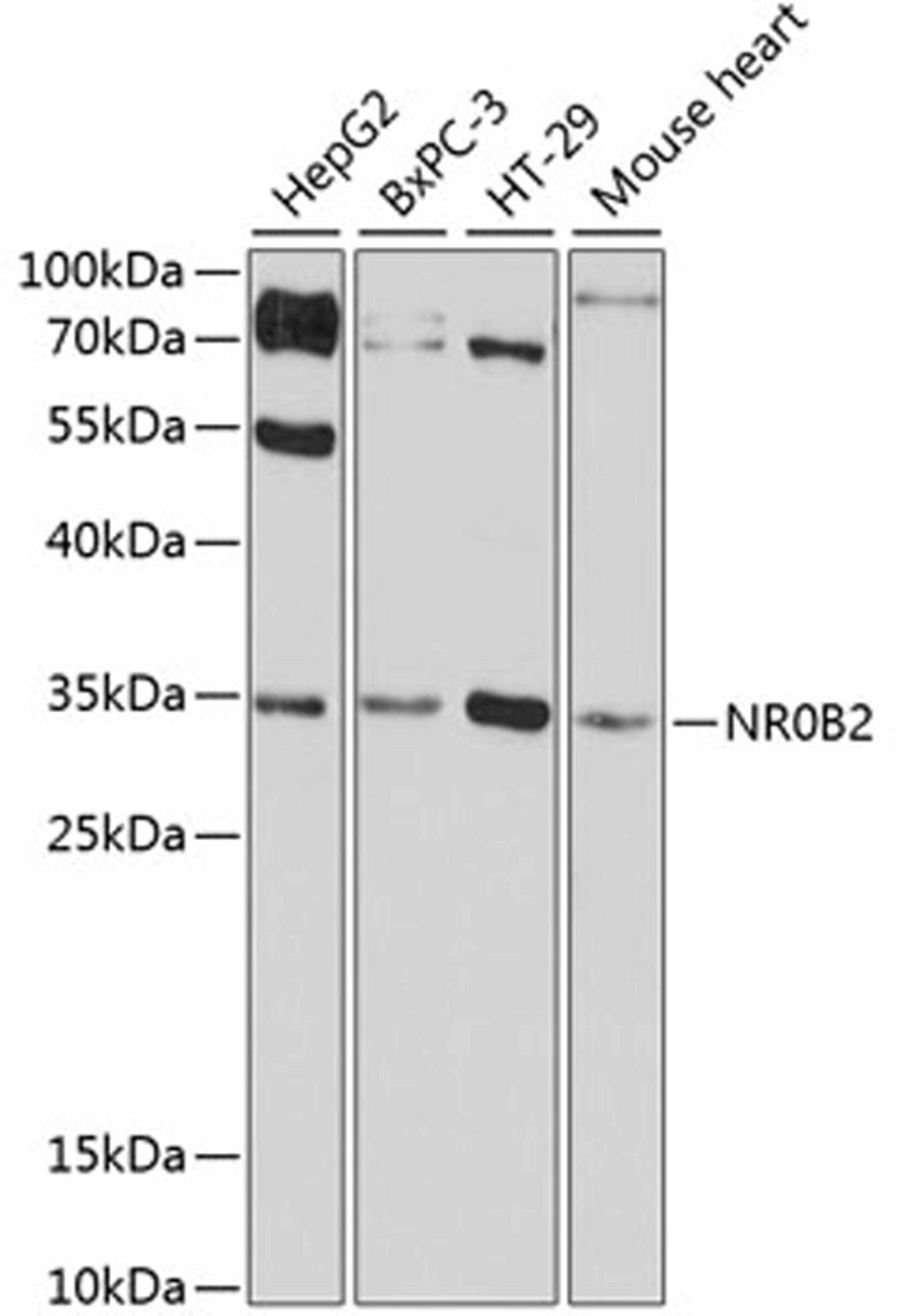 Western blot - NR0B2 antibody (A16454)