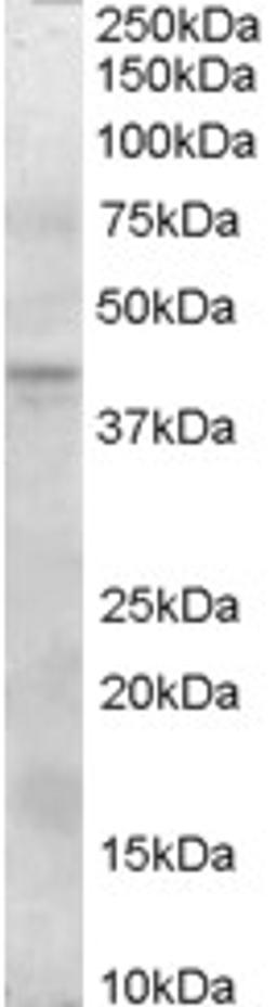 45-884 (0.3ug/ml) staining of Human Pancreas lysate (35ug protein in RIPA buffer). Primary incubation was 1 hour. Detected by chemiluminescence.