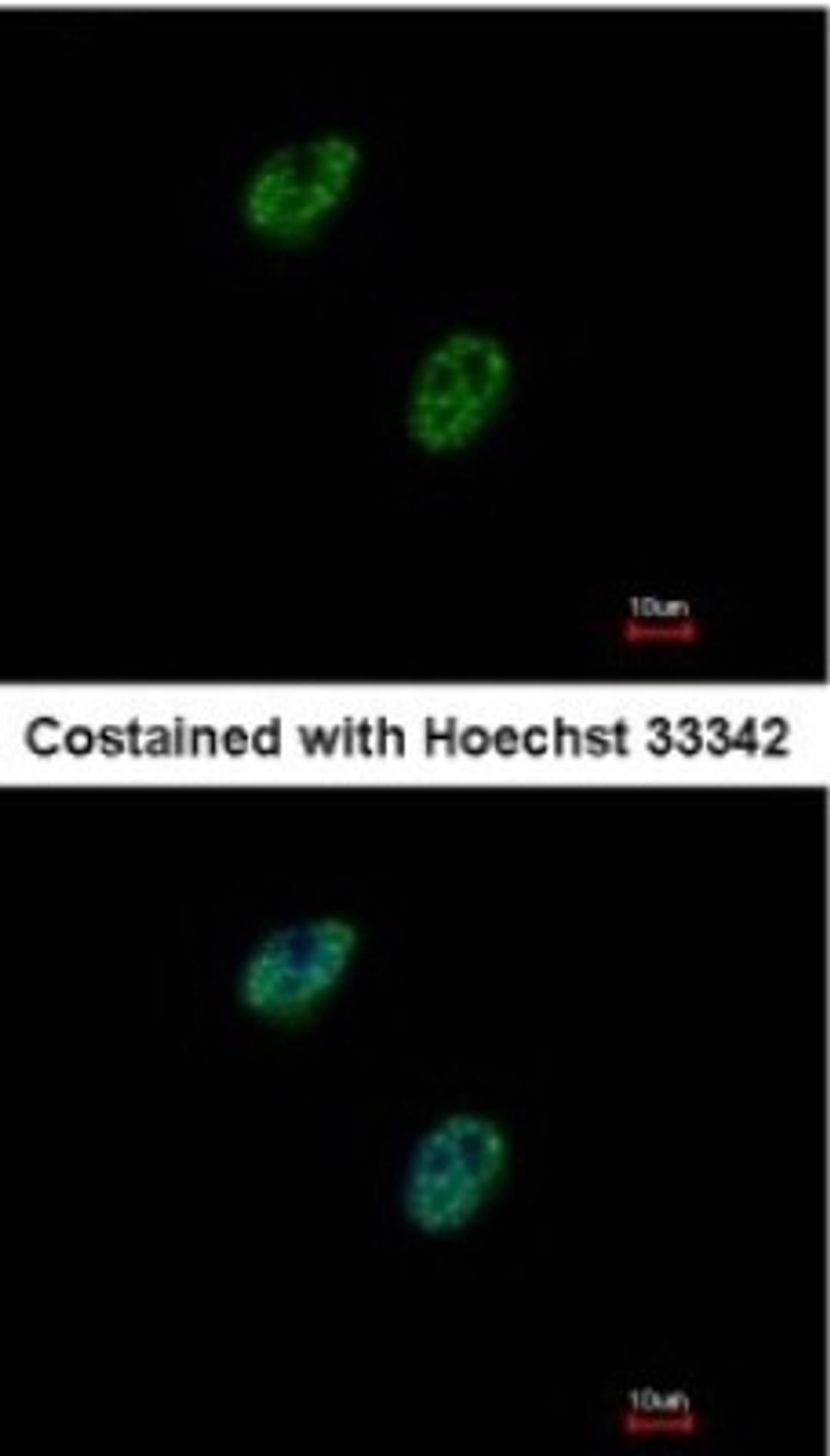 Immunocytochemistry/Immunofluorescence: Gabpb2 Antibody [NBP1-33690] - Paraformaldehyde-fixed HeLa, using antibody at 1:500 dilution.