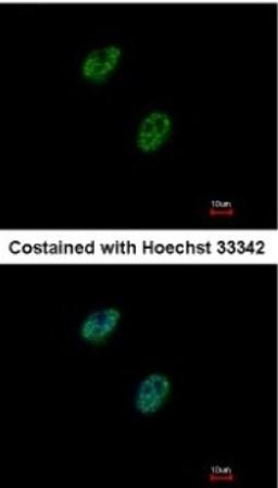 Immunocytochemistry/Immunofluorescence: Gabpb2 Antibody [NBP1-33690] - Paraformaldehyde-fixed HeLa, using antibody at 1:500 dilution.