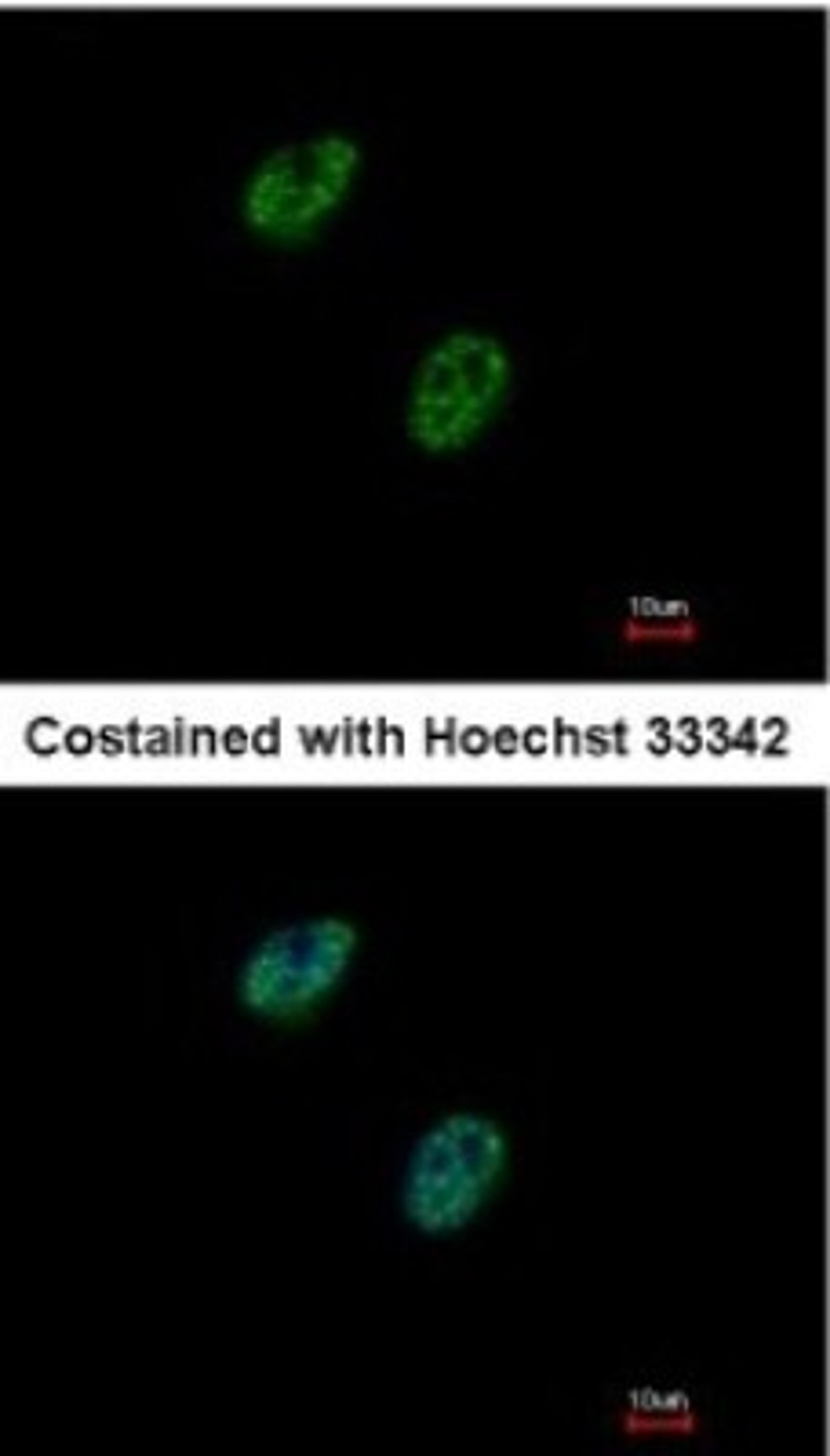 Immunocytochemistry/Immunofluorescence: Gabpb2 Antibody [NBP1-33690] - Paraformaldehyde-fixed HeLa, using antibody at 1:500 dilution.