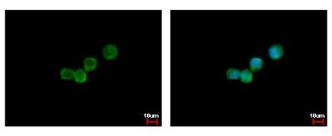 Immunocytochemistry/Immunofluorescence: G-CSF R/CD114 Antibody [NBP2-16629] - Immunofluorescence analysis of methanol-fixed A431, using antibody at 1:500 dilution.