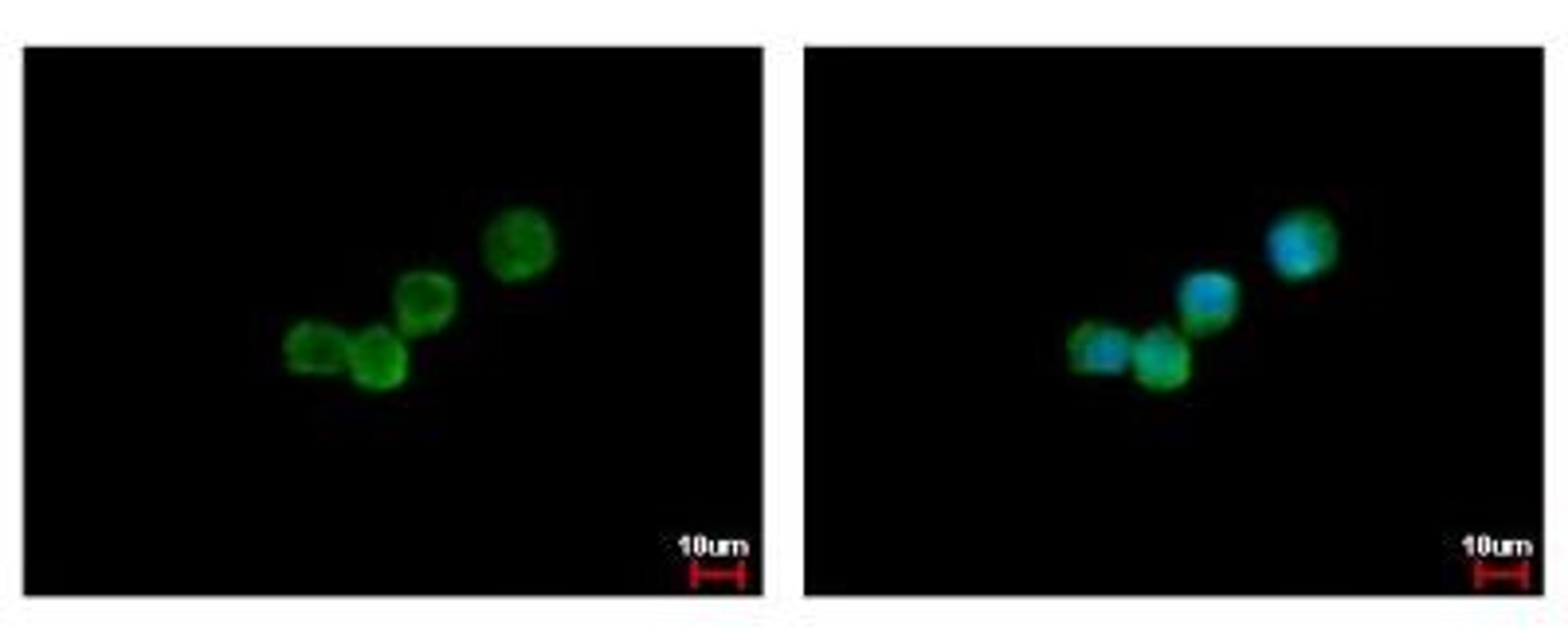 Immunocytochemistry/Immunofluorescence: G-CSF R/CD114 Antibody [NBP2-16629] - Immunofluorescence analysis of methanol-fixed A431, using antibody at 1:500 dilution.