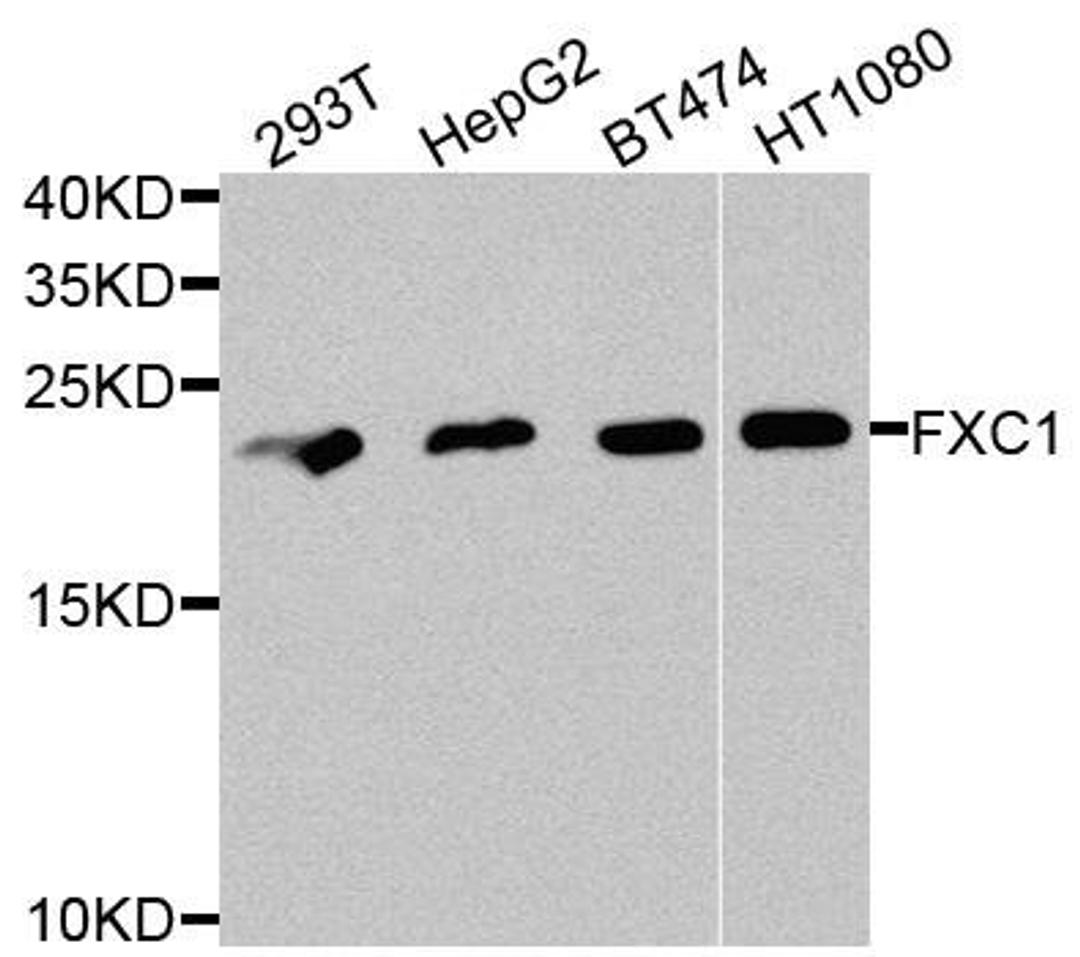 Western blot analysis of extracts of various cells using TIMM10B antibody