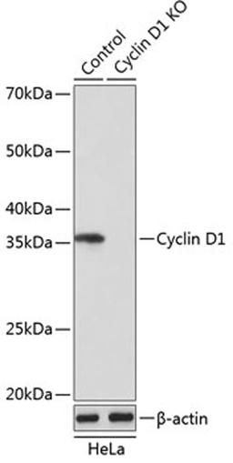 Western blot - Cyclin D1 antibody (A19038)