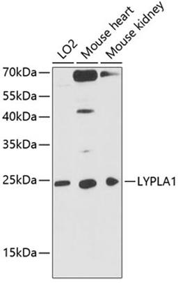 Western blot - LYPLA1 antibody (A4419)