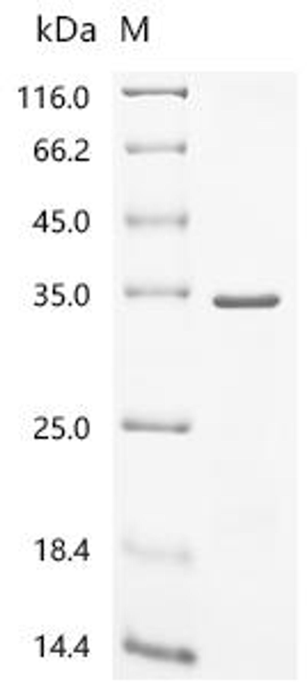 (Tris-Glycine gel) Discontinuous SDS-PAGE (reduced) with 5% enrichment gel and 15% separation gel.