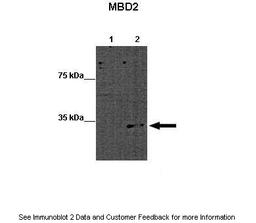 Antibody used in WB on Mouse ES at: 1:1000 (Lane 1: 15ug WT mouse ES lysate, Lane 2: 15ug MBD2 KO mouse ES lysate).