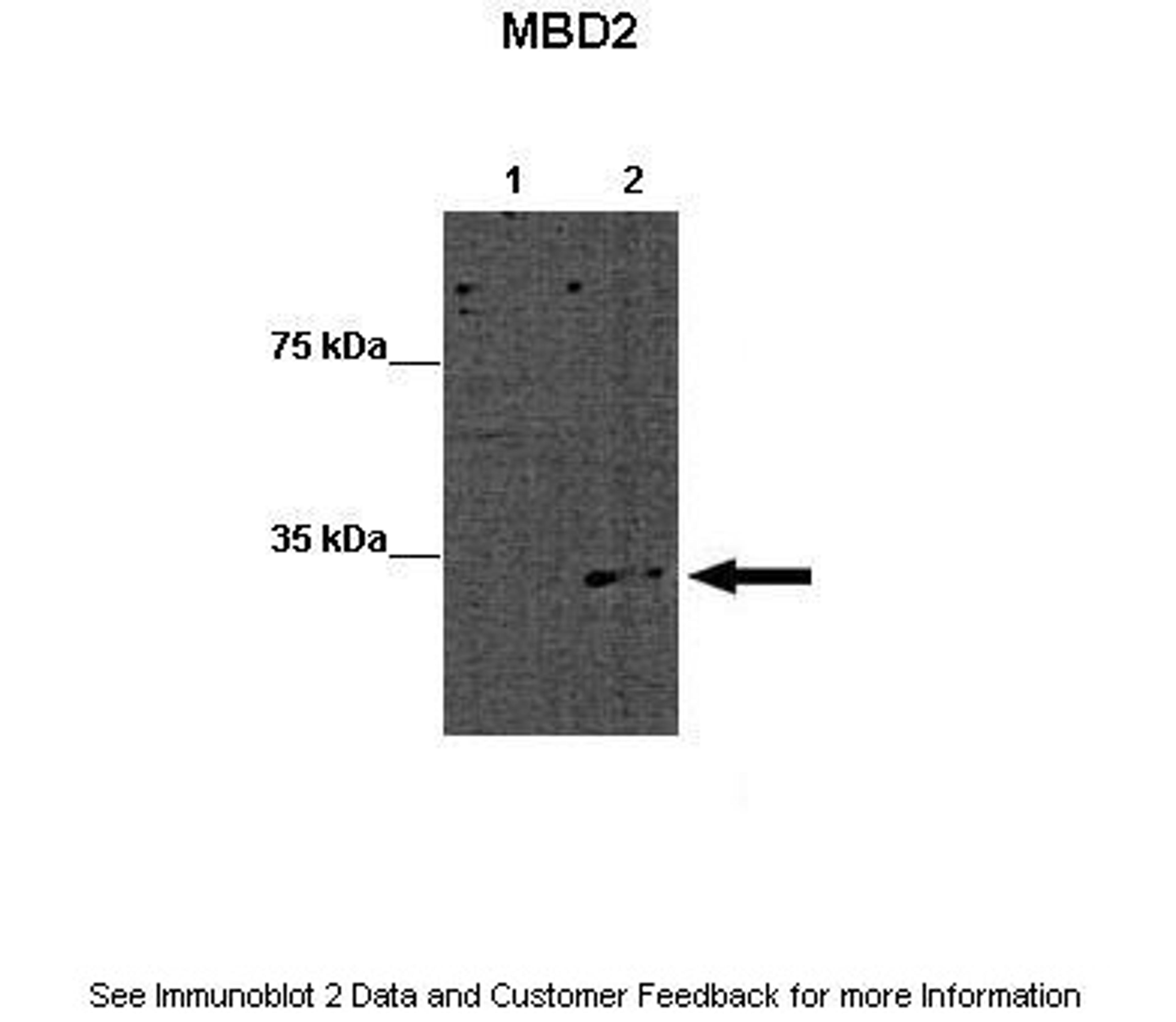 Antibody used in WB on Mouse ES at: 1:1000 (Lane 1: 15ug WT mouse ES lysate, Lane 2: 15ug MBD2 KO mouse ES lysate).