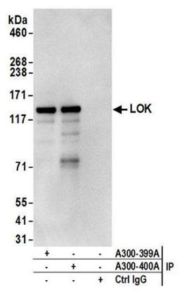 Detection of human LOK by western blot of immunoprecipitates.