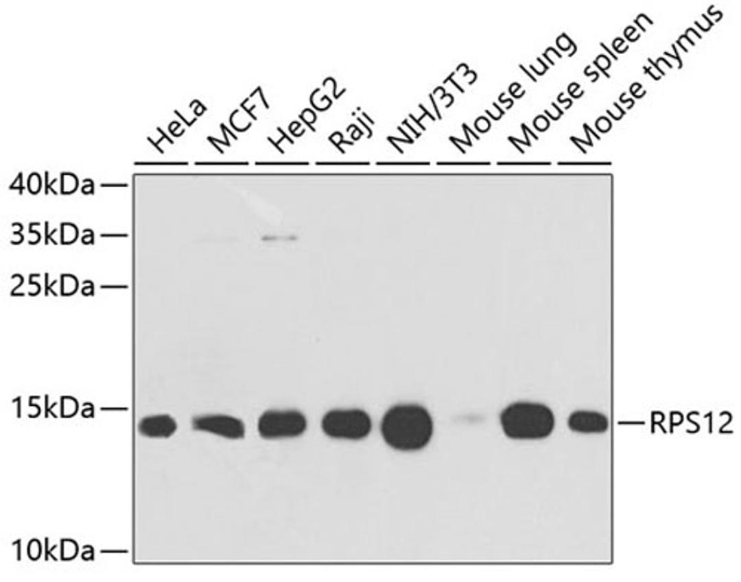 Western blot - RPS12 antibody (A5890)