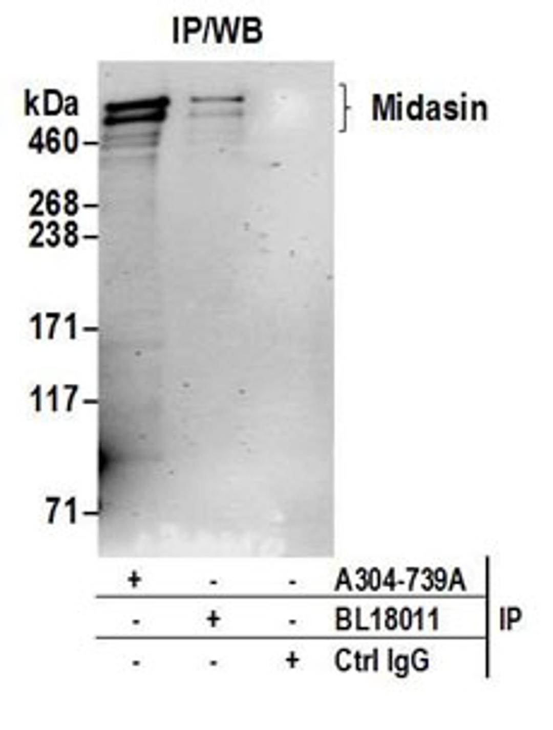 Detection of human Midasin by western blot of immunoprecipitates.