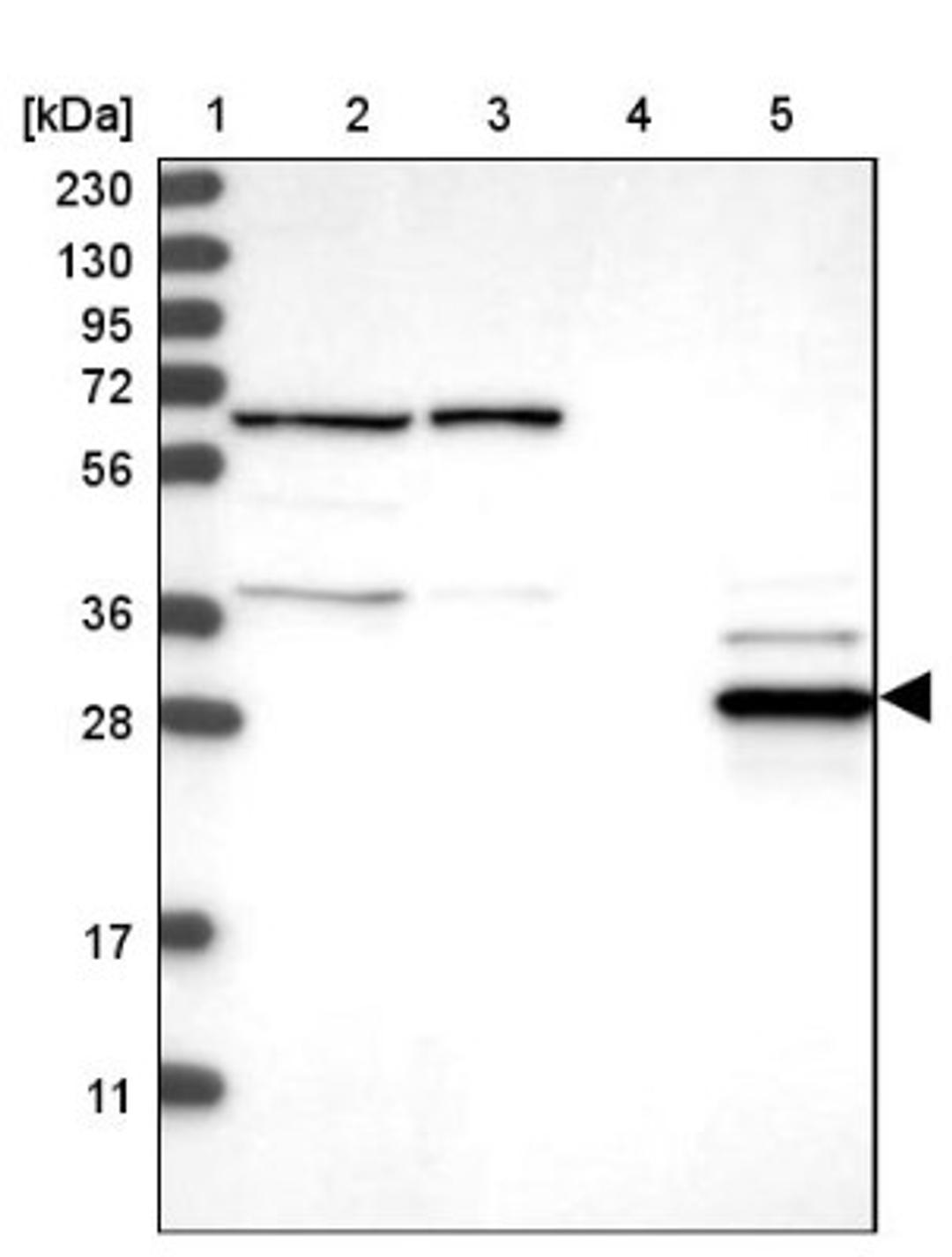 Western Blot: ECHDC2 Antibody [NBP1-83803] - Lane 1: Marker [kDa] 230, 130, 95, 72, 56, 36, 28, 17, 11<br/>Lane 2: Human cell line RT-4<br/>Lane 3: Human cell line U-251MG sp<br/>Lane 4: Human plasma (IgG/HSA depleted)<br/>Lane 5: Human liver tissue