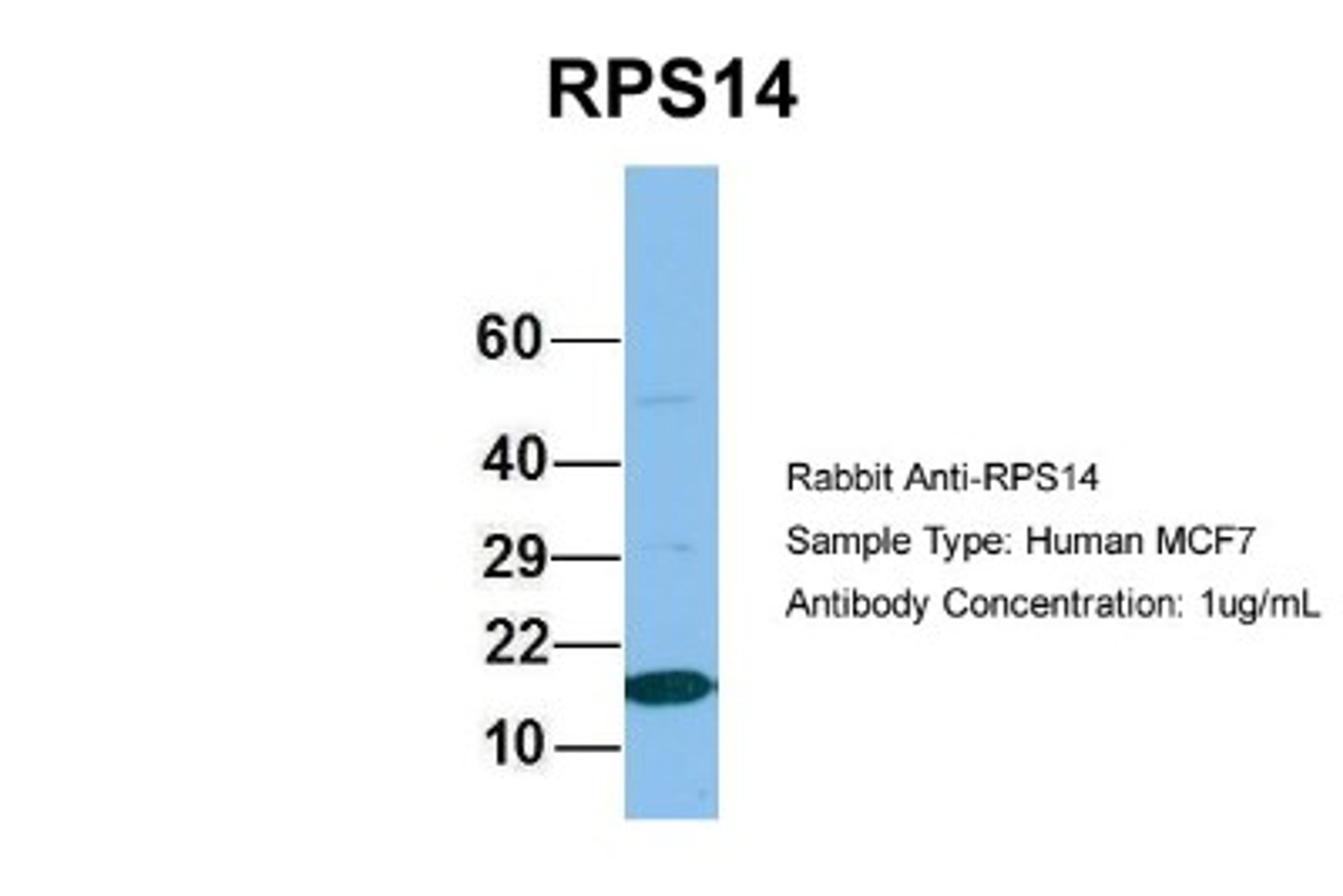 Western Blot: RPS14 Antibody [NBP1-57365] - MCF7, Antibody Dilution: 1.0 ug/ml RPS14 is supported by BioGPS gene expression data to be expressed in MCF7.