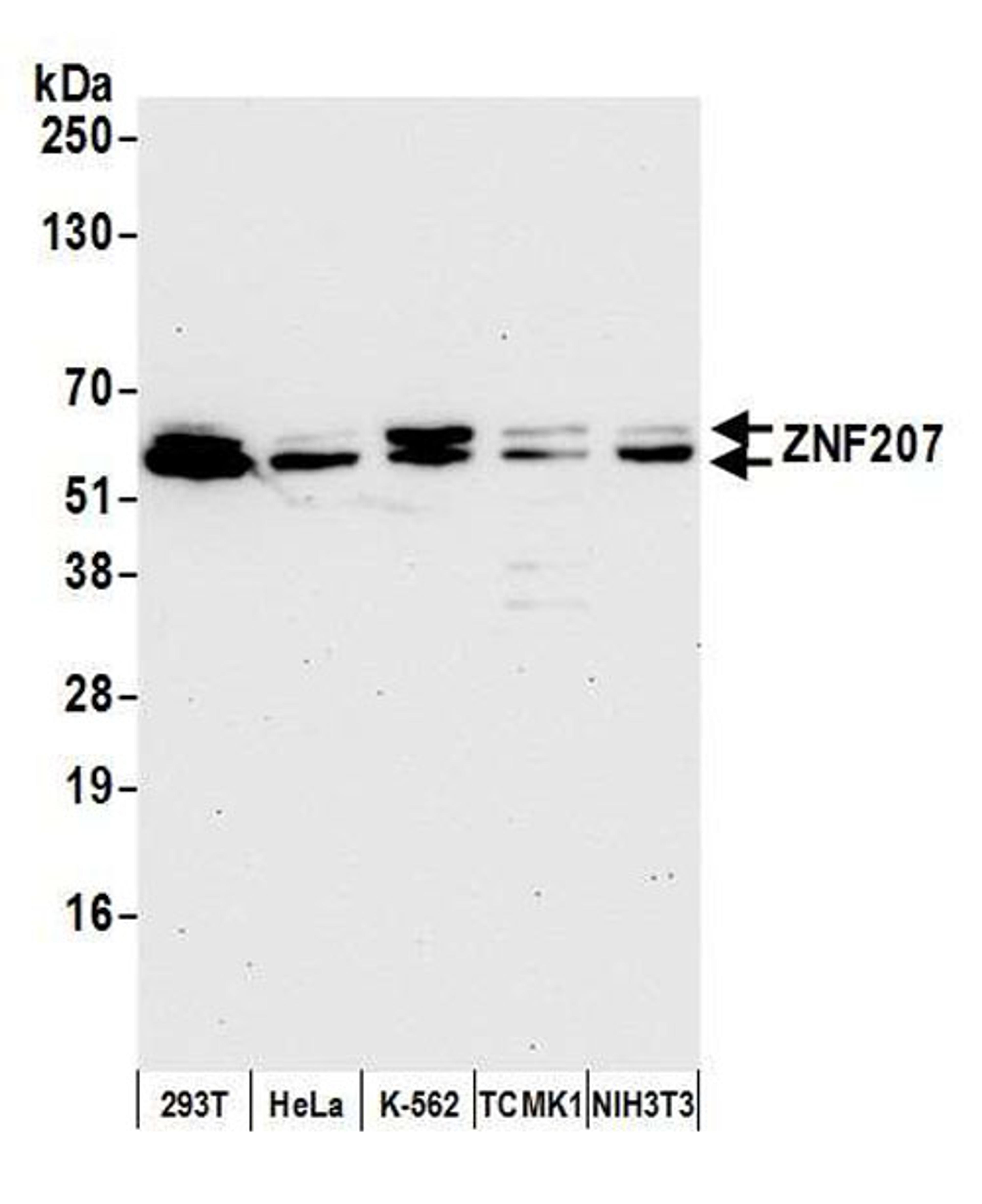 Detection of human and mouse ZNF207 by WB.