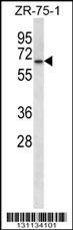 Western blot analysis in ZR-75-1 cell line lysates (35ug/lane).