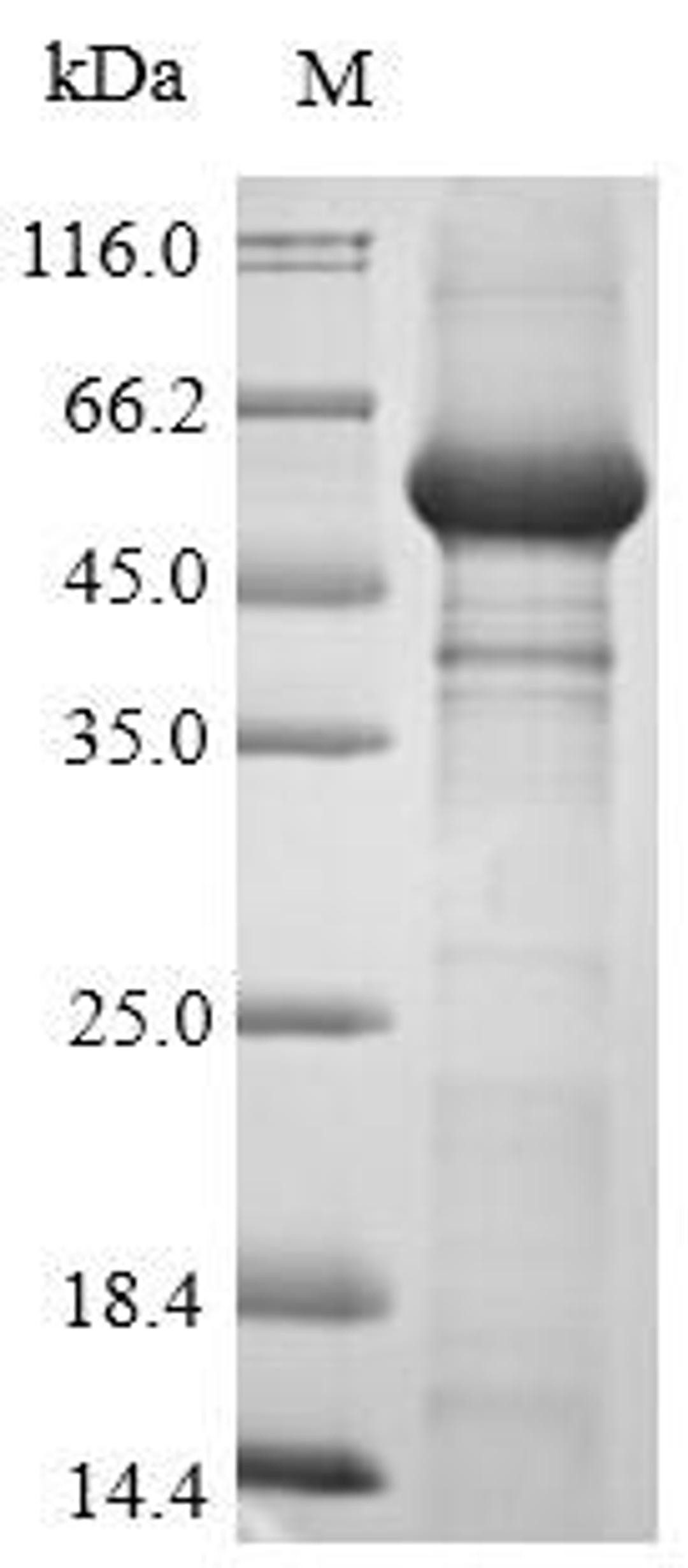 (Tris-Glycine gel) Discontinuous SDS-PAGE (reduced) with 5% enrichment gel and 15% separation gel.