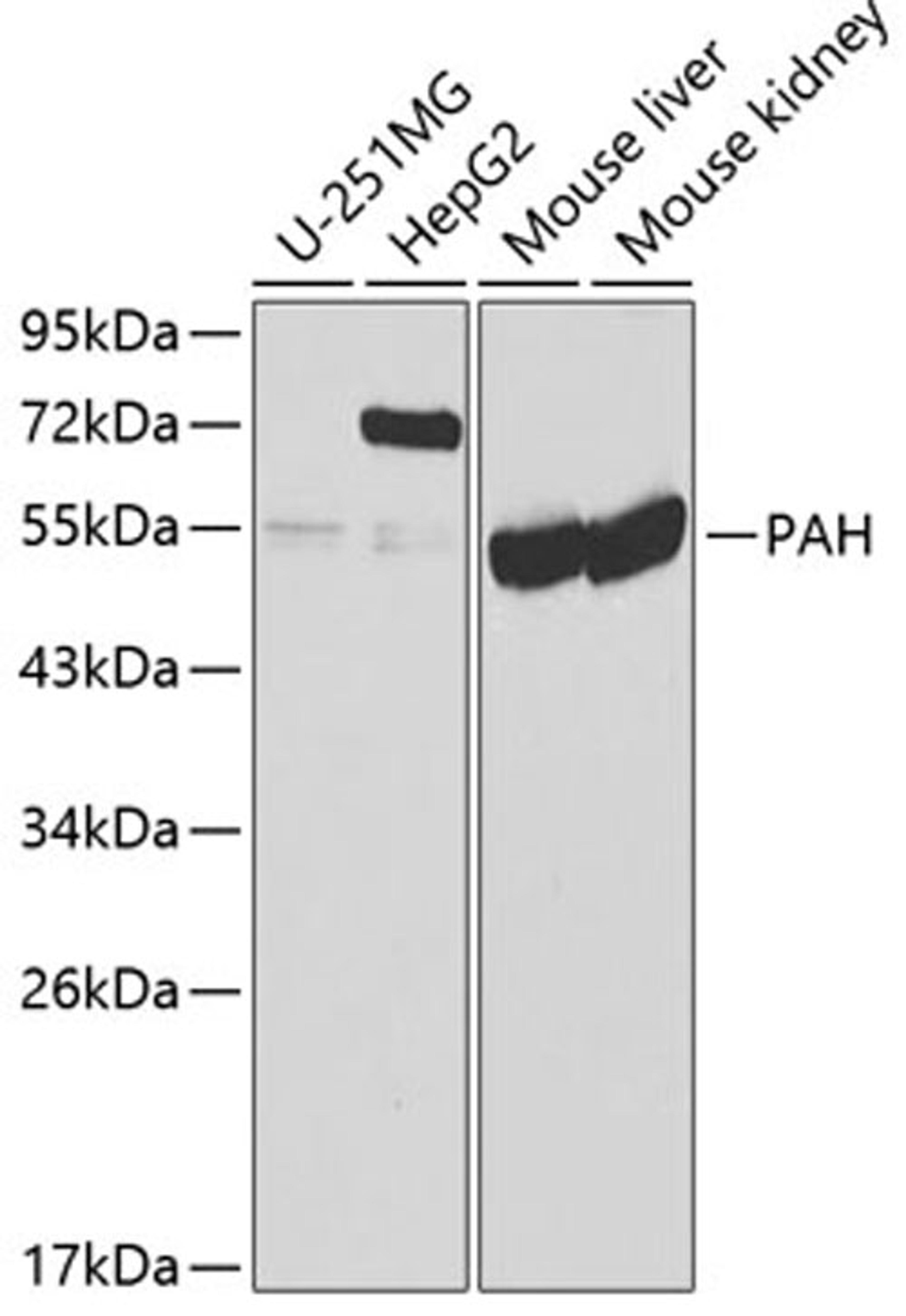 Western blot - PAH antibody (A1559)