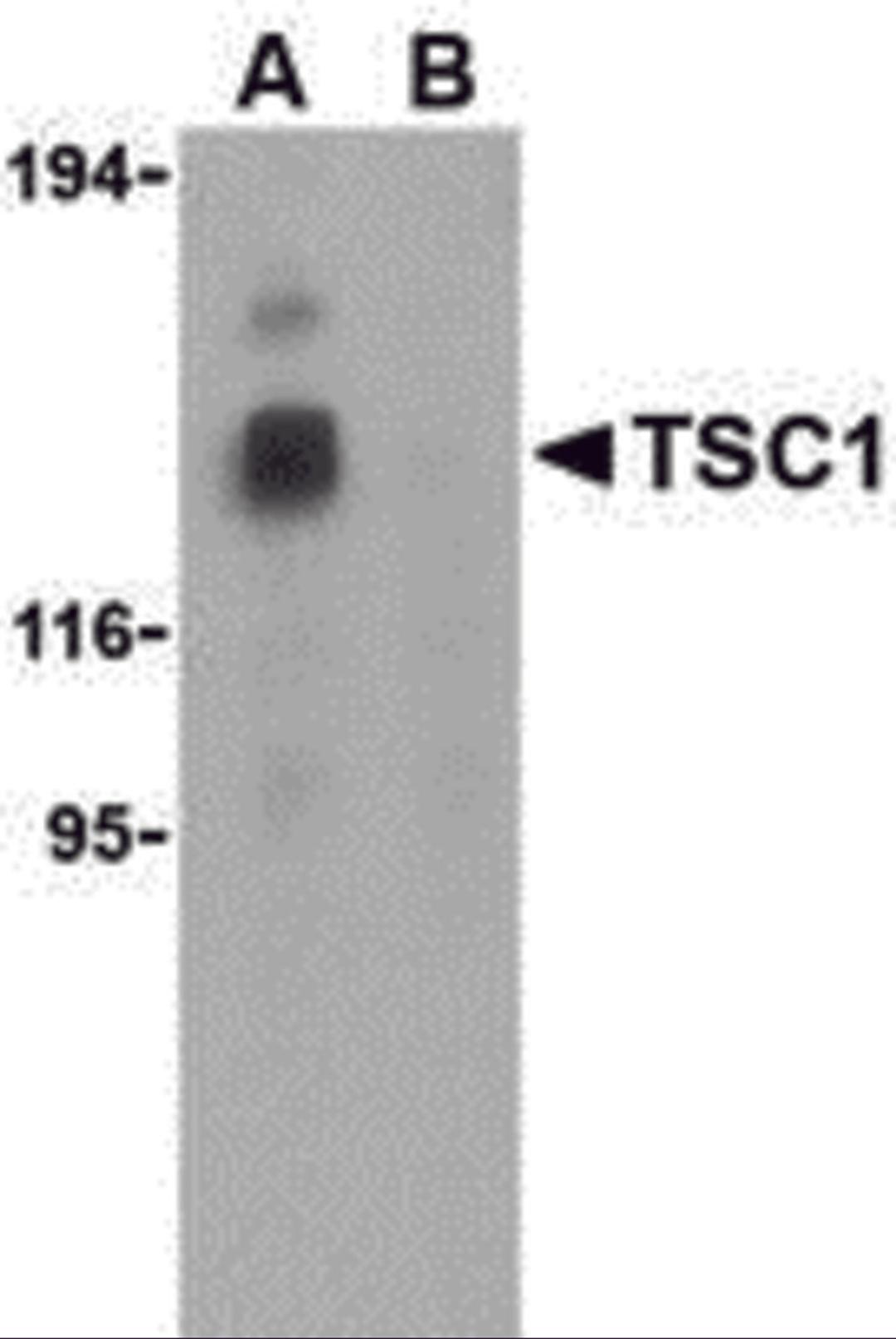 Western blot analysis of TSC1 in EL4 cell lysate with TSC1 antibody at 1 μg/mL in the (A) absence and (B) presence of blocking peptide.