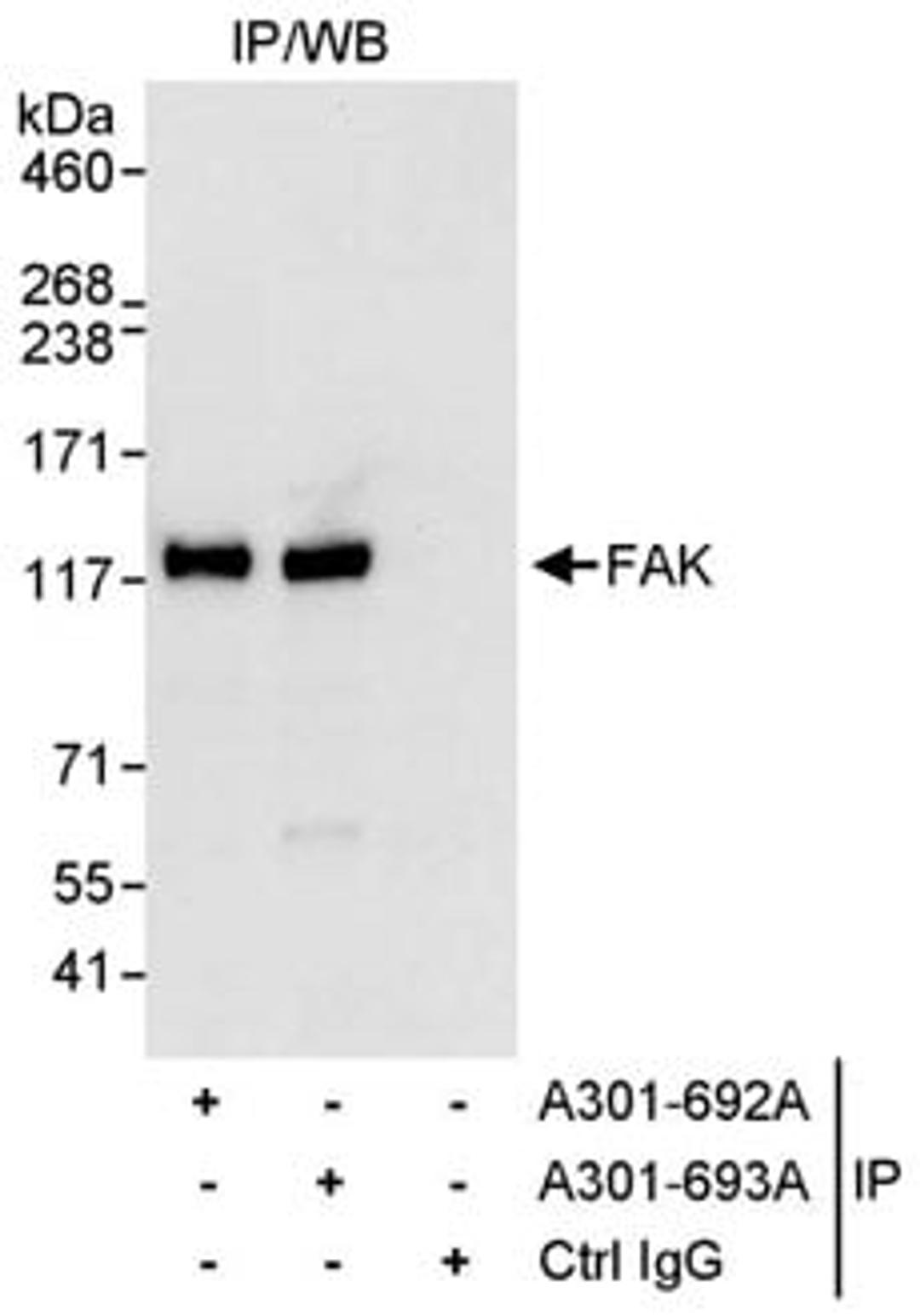 Detection of human FAK by western blot of immunoprecipitates.