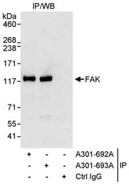 Detection of human FAK by western blot of immunoprecipitates.