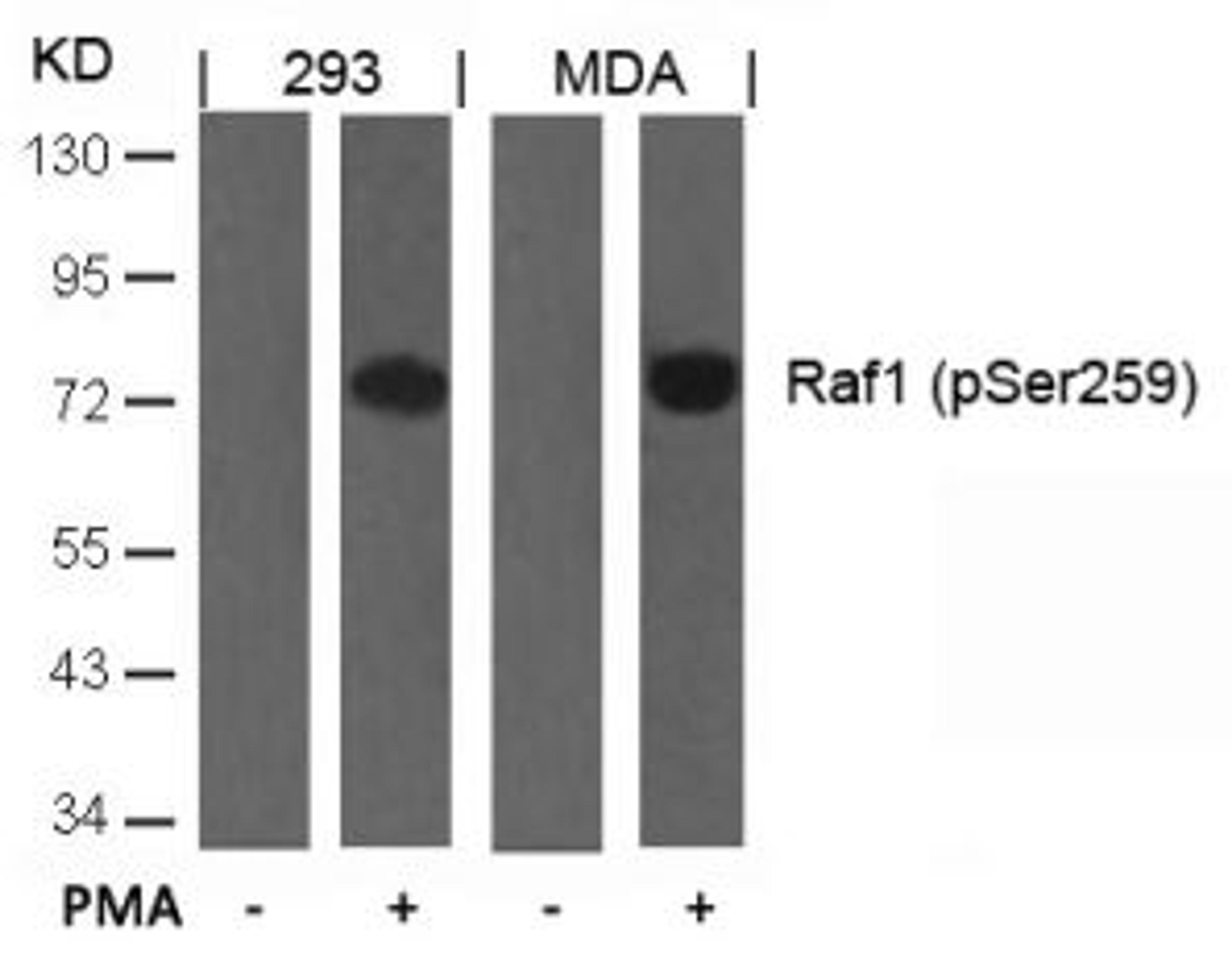 Western blot analysis of lysed extracts from 293 and MDA cells untreated or treated with PMA using Raf1 (Phospho-Ser259).