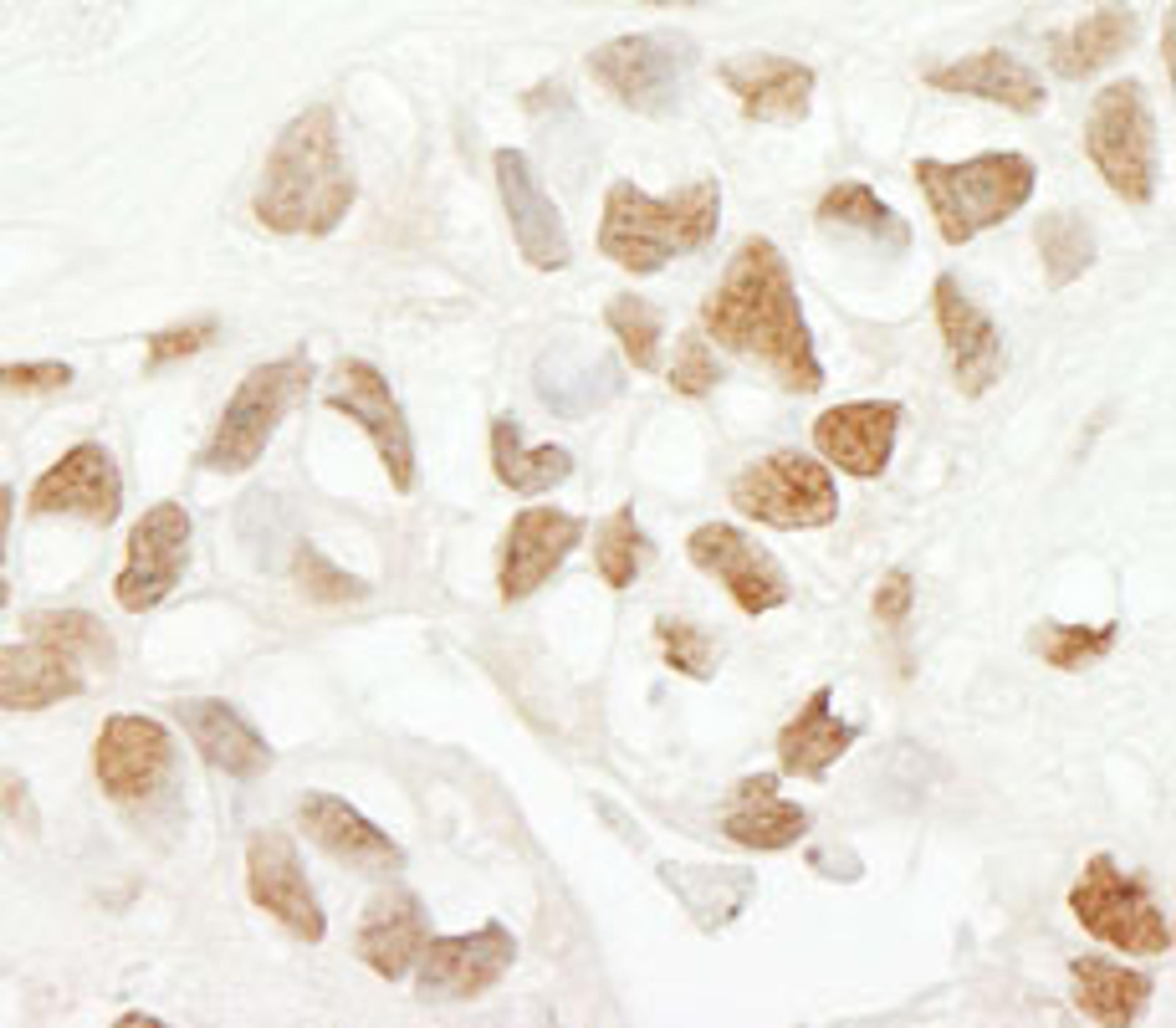 Detection of human SRcyp by immunohistochemistry.